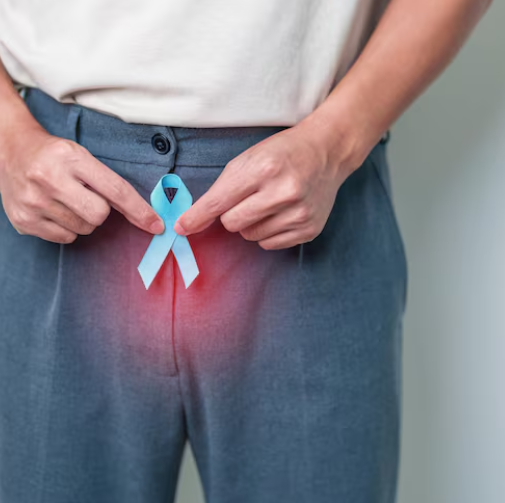 Why Prostate Cancer Care Starts Long Before Treatment