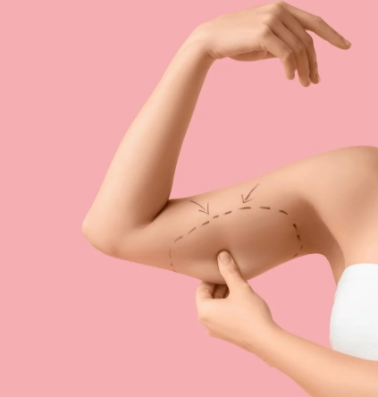 Best Arm Lift Surgeons in Miami for Post-Weight-Loss Patients